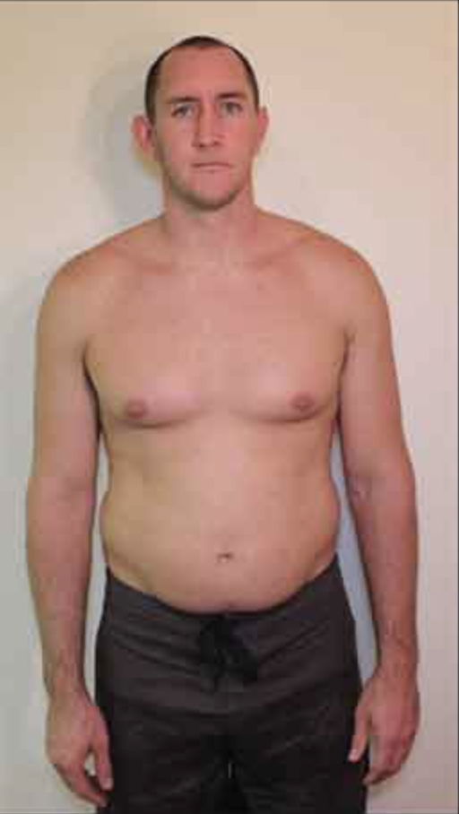 Client James before RAKHAWY coaching — 92kg starting weight